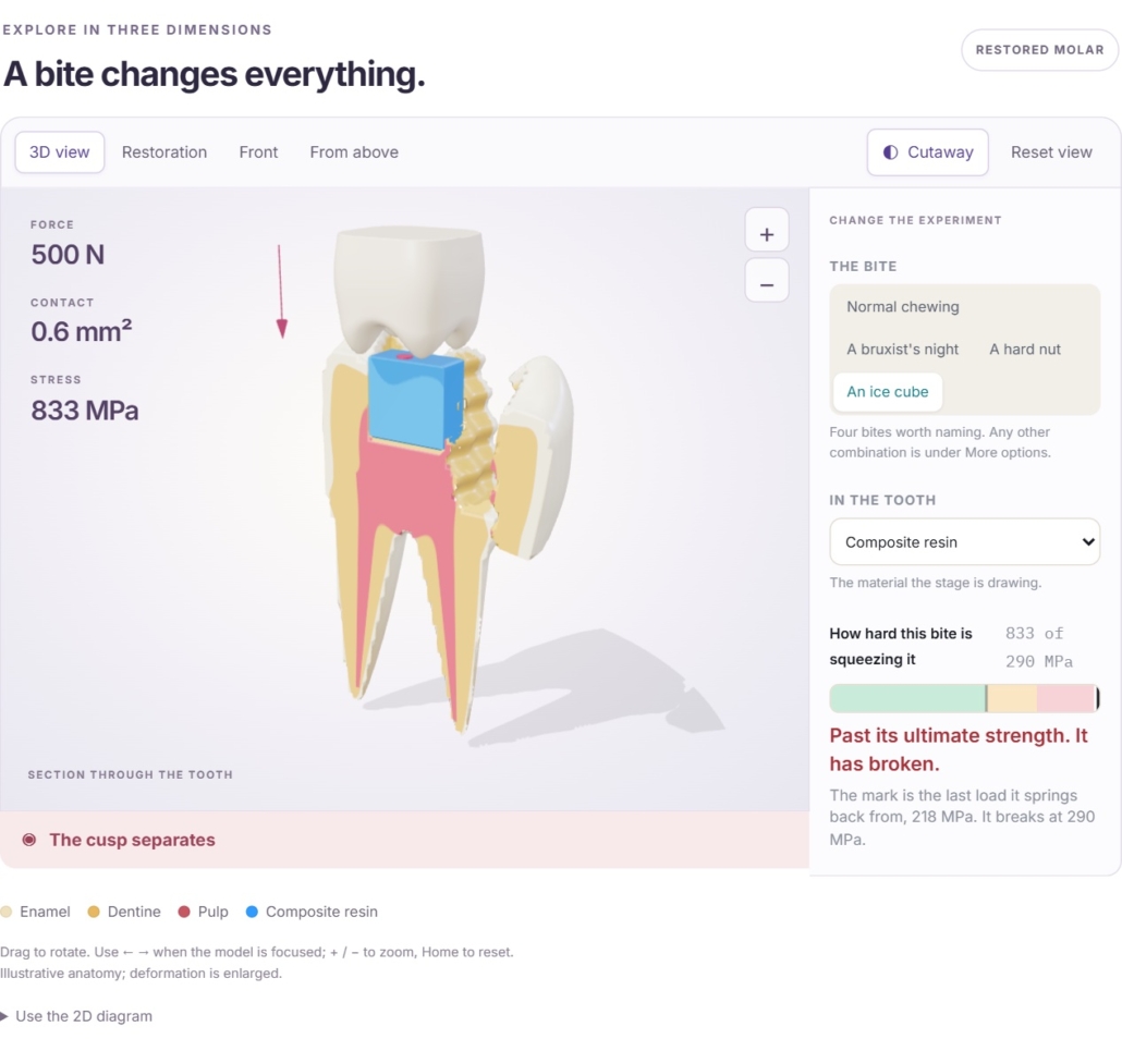diagram of a tooth nd how to create a filling from a textbook