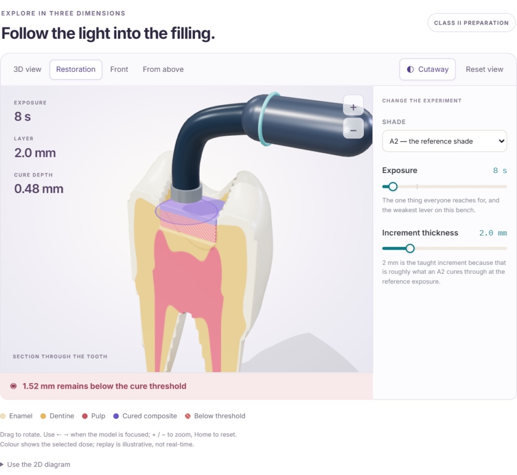 diagram of a tooth nd how to create a filling from a textbook